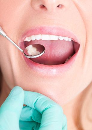 Closeup of smile during dental exam