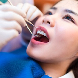 woman getting dental checkup in Cambria