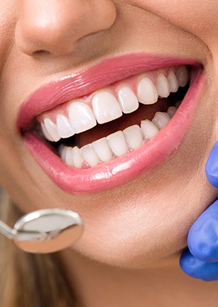 Closeup of healthy smile