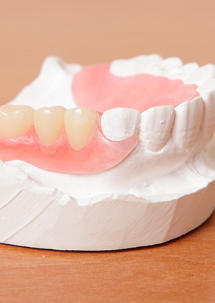 Model smile with partial denture