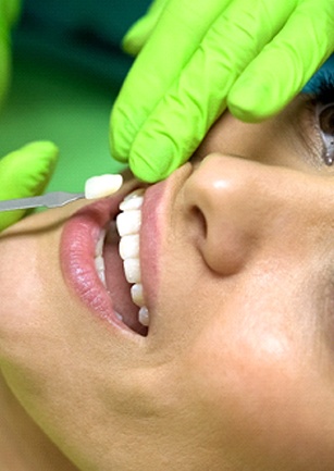 Woman having veneers in Cambria placed by dentist