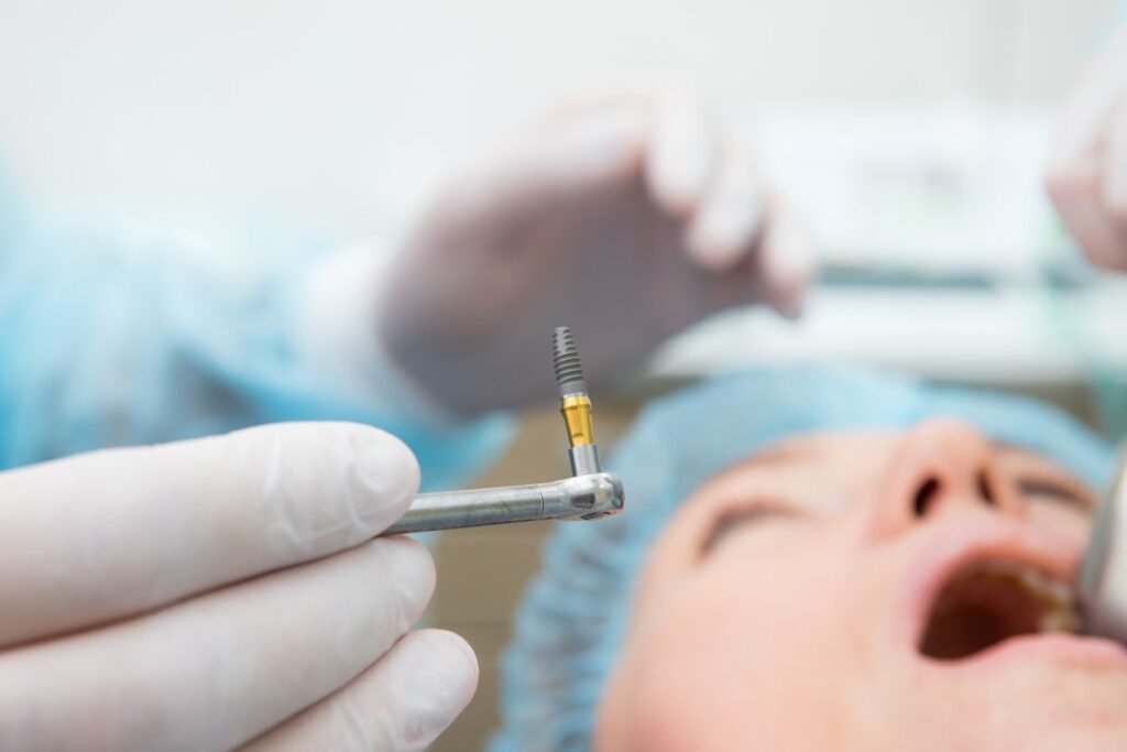 A dental implant surgery